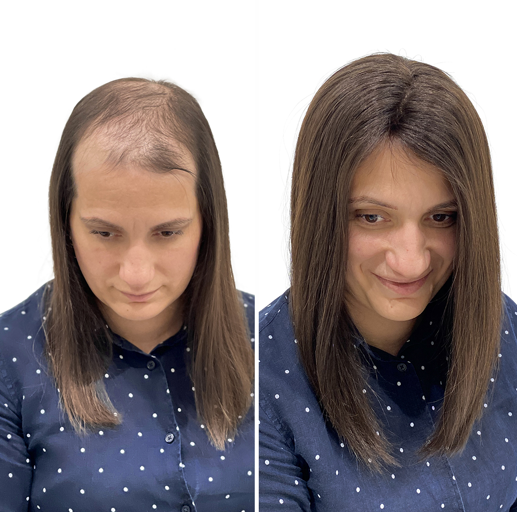 https://hairtalk.ru/wp-content/uploads/2021/12/заказная-по-шаблону-с-головы-система-волос-3-тон.jpg
