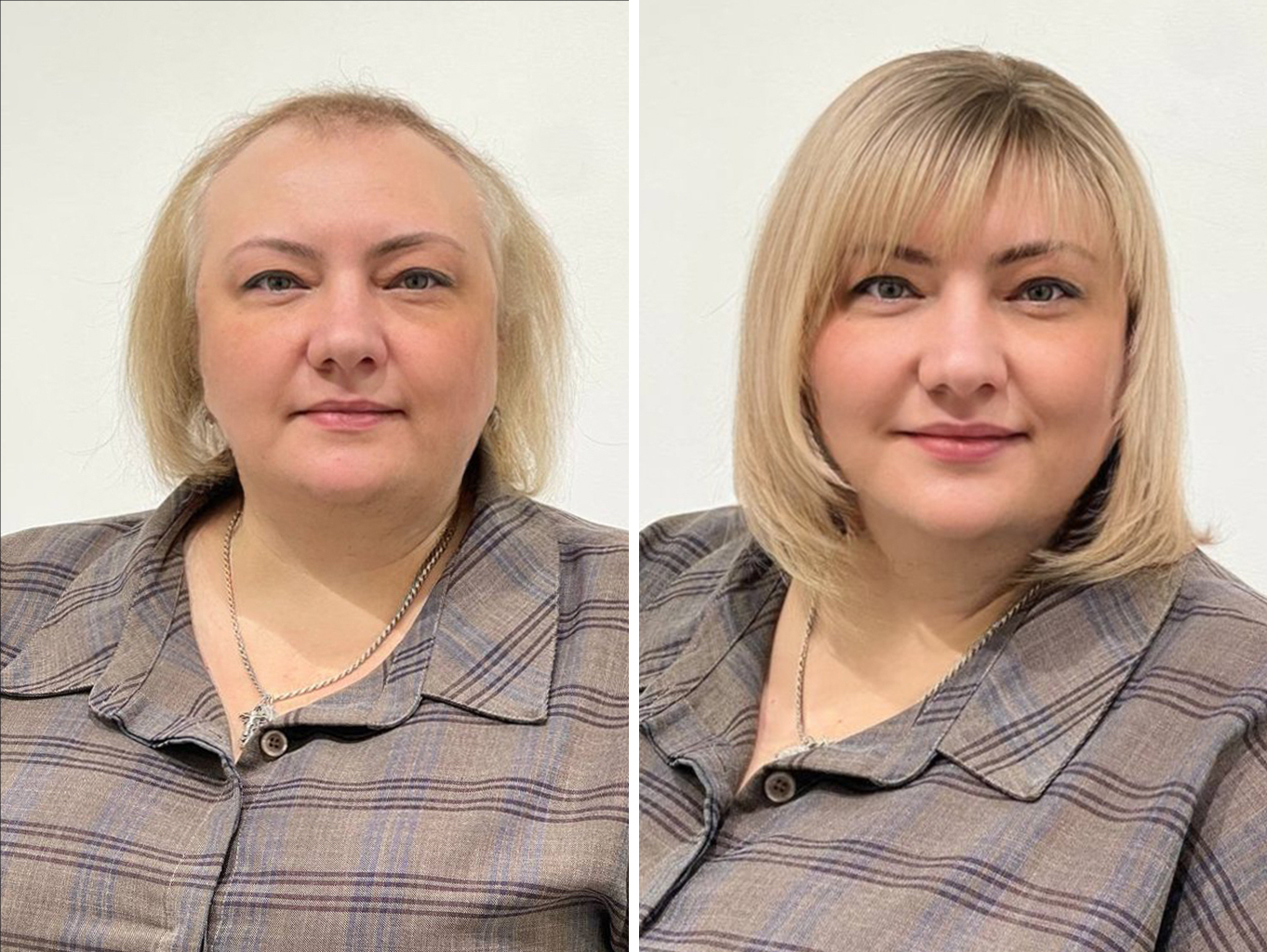 https://hairtalk.ru/wp-content/uploads/2022/12/женщина-в-системе-волос-до-и-после-лицом.jpg